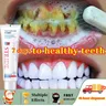 Zahnstein entferner Zahn aufhellung Zahnpasta Mundgeruch entfernung Mundgeruch verhindern