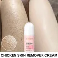 Body Cream Chicken Skin Removal Treatment Keratosis Pilaris Lotion Rough Bumpy Pore Spots Care