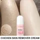 Removal Chicken Skin Body Lotion Treatment Keratosis Pilaris Lotion Rough Bumpy Pore Spots Care