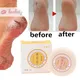 20g Oil Anti-Drying Crack Foot Cream Heel Cracked Repair Cream Removal Dead Skin Hand Feet Care Foot