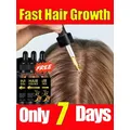 Unisex Hair growth oil effective baldness repair hereditary hair loss postpartum hair loss Treatment