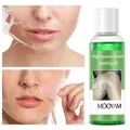 100ml High Power Green Peeling Oil Whitening Lighten Elbows Knees Hands Even Skin Tone Moisturizing