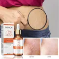 Stretch Marks Repair Essential Oil Skin Care Treatment Cream For Maternity Remover Anti-Wrinkle