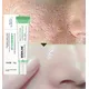 Salicylic Acid Pore Shrinking Serum Cream Face Removing Large Pores Acne Pimple Treatment Repairing