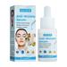 AIDAIMZ Pure Hydration Serum Soothing Face Serum with Hyaluronic Acid and Zinc to Calm Redness and Irritated Skin Ultra-Hydrating Anti-Wrinkle Hyaluronic Acid Serum for All Skin Types