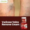 Crema per il trattamento delle vene Varicose cura dei piedi Patch per le gambe del ragno Varicose