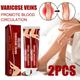 (2 pcs) Varicose Veins Vasculitis Treatment Foot Anti Swelling Spider Leg Massage Cream