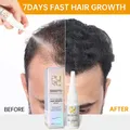 PURC Biotin Collagen Hair Serum Spray Improves Scalp Environment Men Women Strong Hair Roots Dry