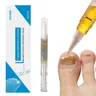 3ml Nagel pilz behandlung Pen Anti-Pilz-Infektion biologische Reparatur lösung nahrhaftes Öl 3ml