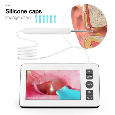 Digital Otoscope with 4.3 inch Screen 1080p HD Smart Visual Ear Camera Ear Wax Removal Tool Camera