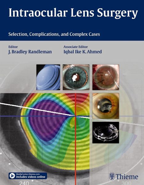 Intraocular Lens Surgery - Bradley Randleman, Iqbal Ike K. Ahmed