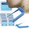 Skin Care Rubber Bands Skin Tag Remover Skin Tag Removal Kit Face Care Mole Wart Tool Skincare Green Beauty & Health