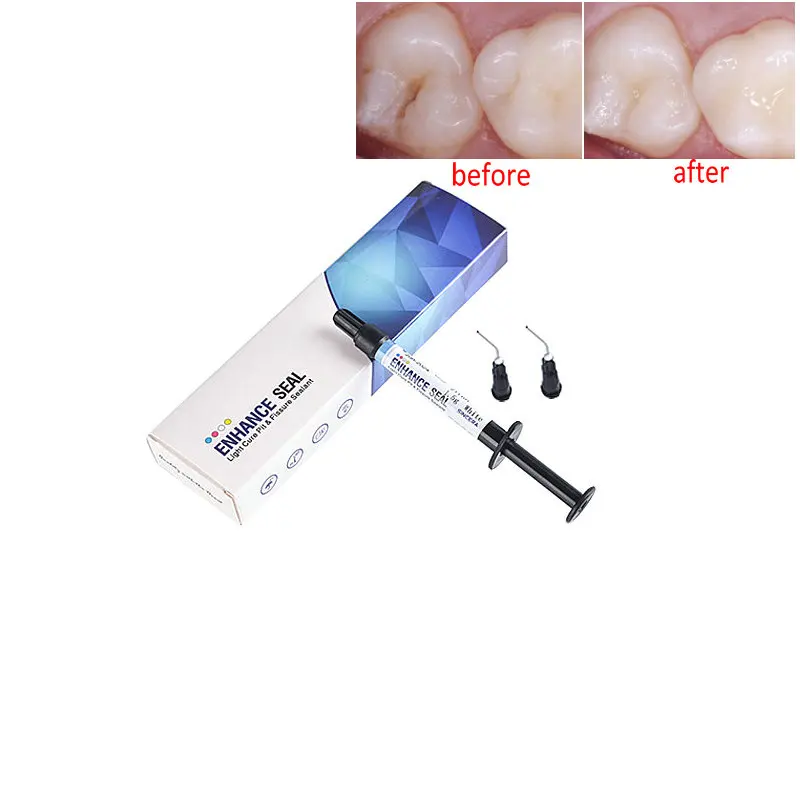 Dental Light Cure Pit und Fissure Sealant zur Bildung von Karies in Hohlräumen und Zähnenöpfchen Image