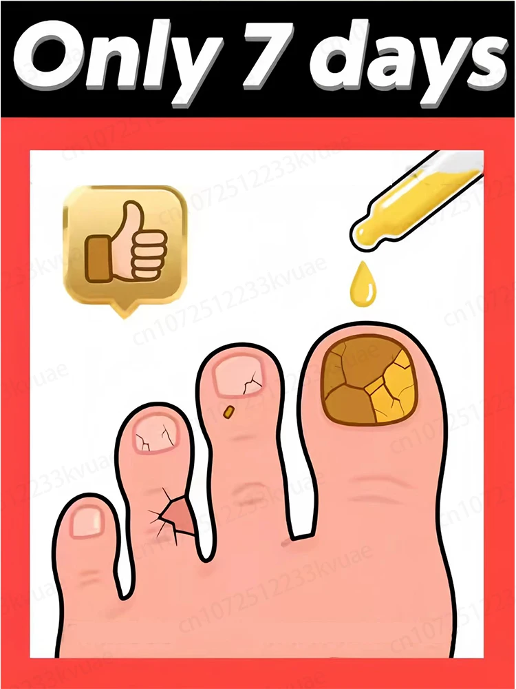 Beseitigt den Pilz schnell und stellt gesunde Nägel wieder her Image