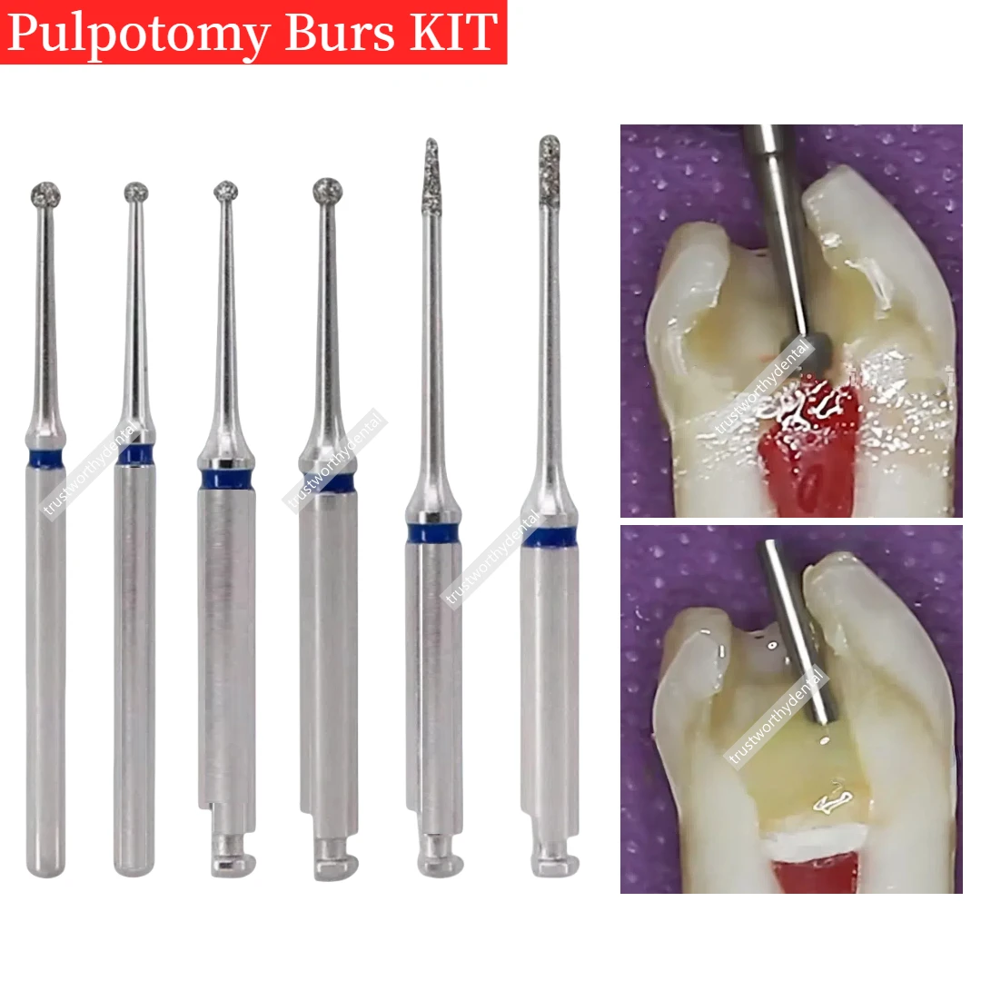 Dental Pulpotomie Burs Kit Zugang Offenen Zellstoff Hohlraum Bur Kit Zellstoff Entfernen Bohrer Ball Bohrer Hohlraum Baby Zahn Bur Wurzel Kanal Behandlung Image