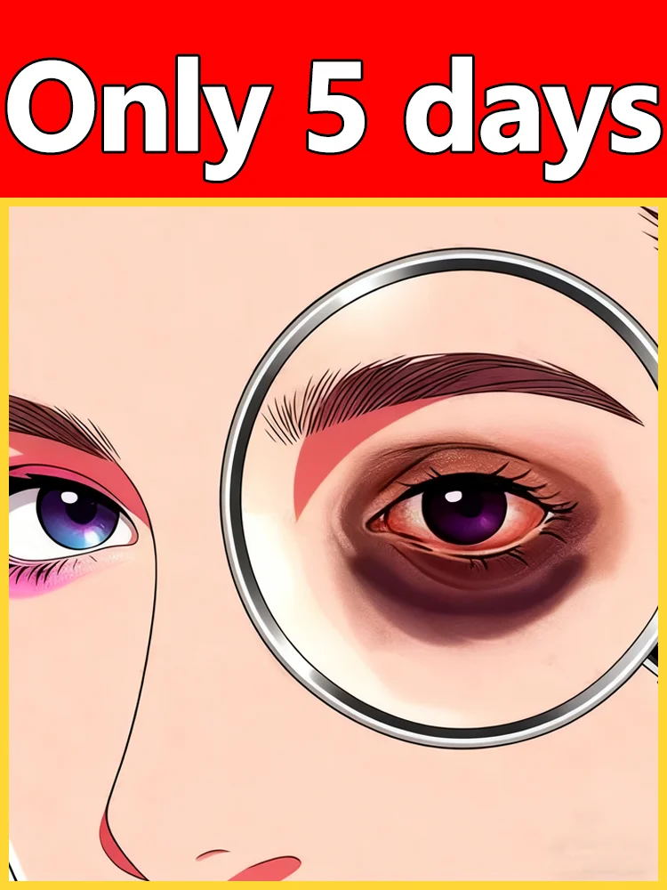 Tiefe Augen. Tief feuchtigkeitsspendend, entfernt schnell Tränensäcke und schützt die Augenpartie Image