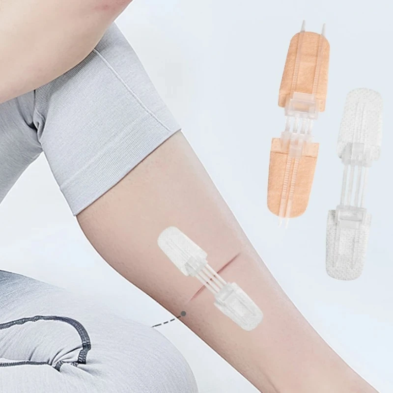 Medizinisches Gummiband im Reißverschluss-Stil, umkehrbar, Rückgabe und Upgrade, kein Nahtband, Haut-Wundverband, Verletzung, praktisch Image