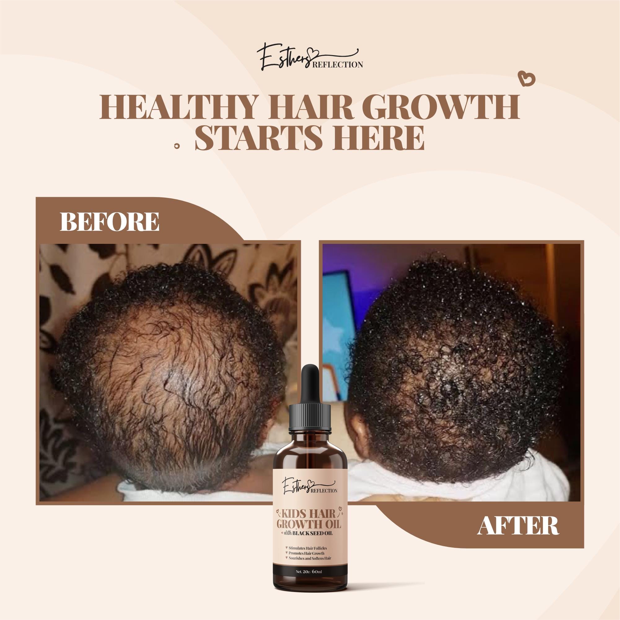 Olio per la crescita dei capelli per bambini, Olio per la crescita dei capelli con olio di semi neri, Olio per la crescita dei capelli per bambini, Ol