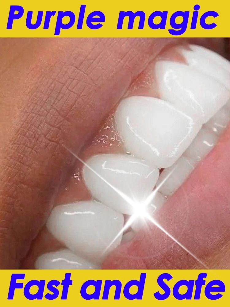 Color Correcting Advanced Teeth Whitening Toothpaste 1 Bottle