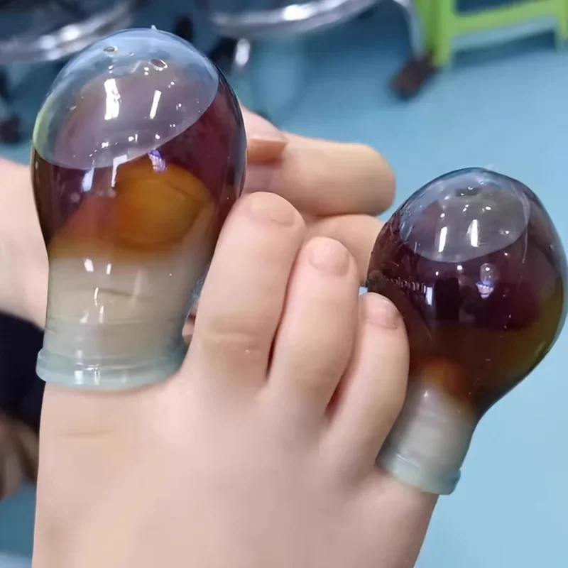 Soak Potion Fingerlinge für Zehen- und Fingerverletzungen, Wunddusche, wasserdichte Schutzhülle, Fußpflege-Werkzeug für Männer und Frauen Image