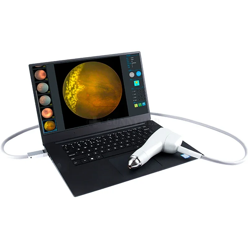 SY-V095 Ophthalmic Wide Field Imaging System nicht-mydriatic Retinal Wide Field Color Retinal Image