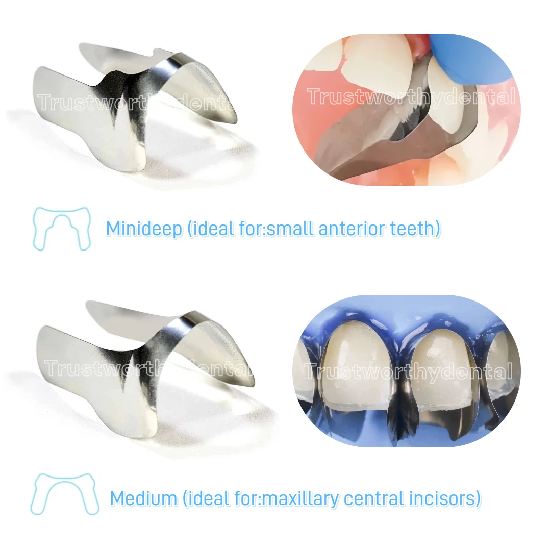 Dental Twin Front Matrix 0,03 mm abschnittsweise konturierte Metallmatrizen Edelstahl Minideep M8 2.0 Frontrestaurierung Unica Image