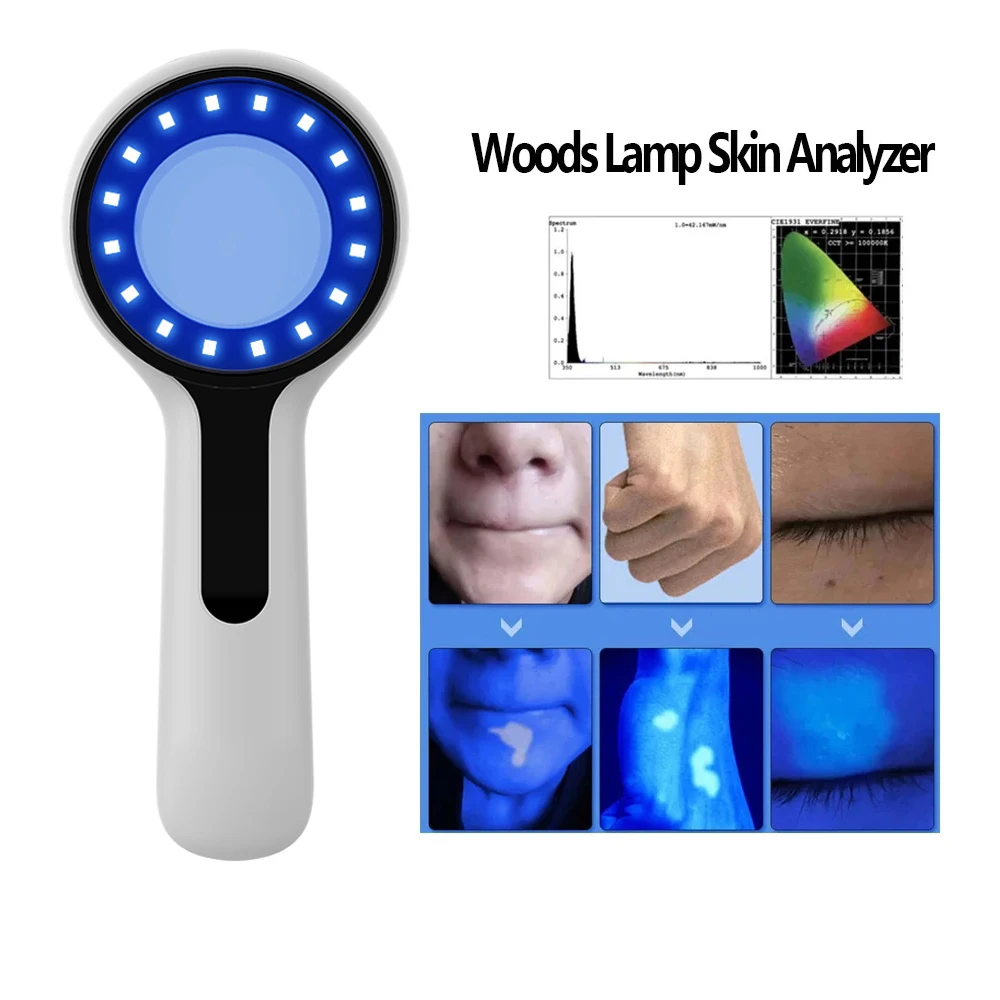 NEUE Woods-Lampe Hautanalysegerät für Schönheits-Gesichtsuntersuchungen Wood-Lampe Licht zur Hautanalyse UV-Vergrößerung Hautanalyse Hautpflege Image