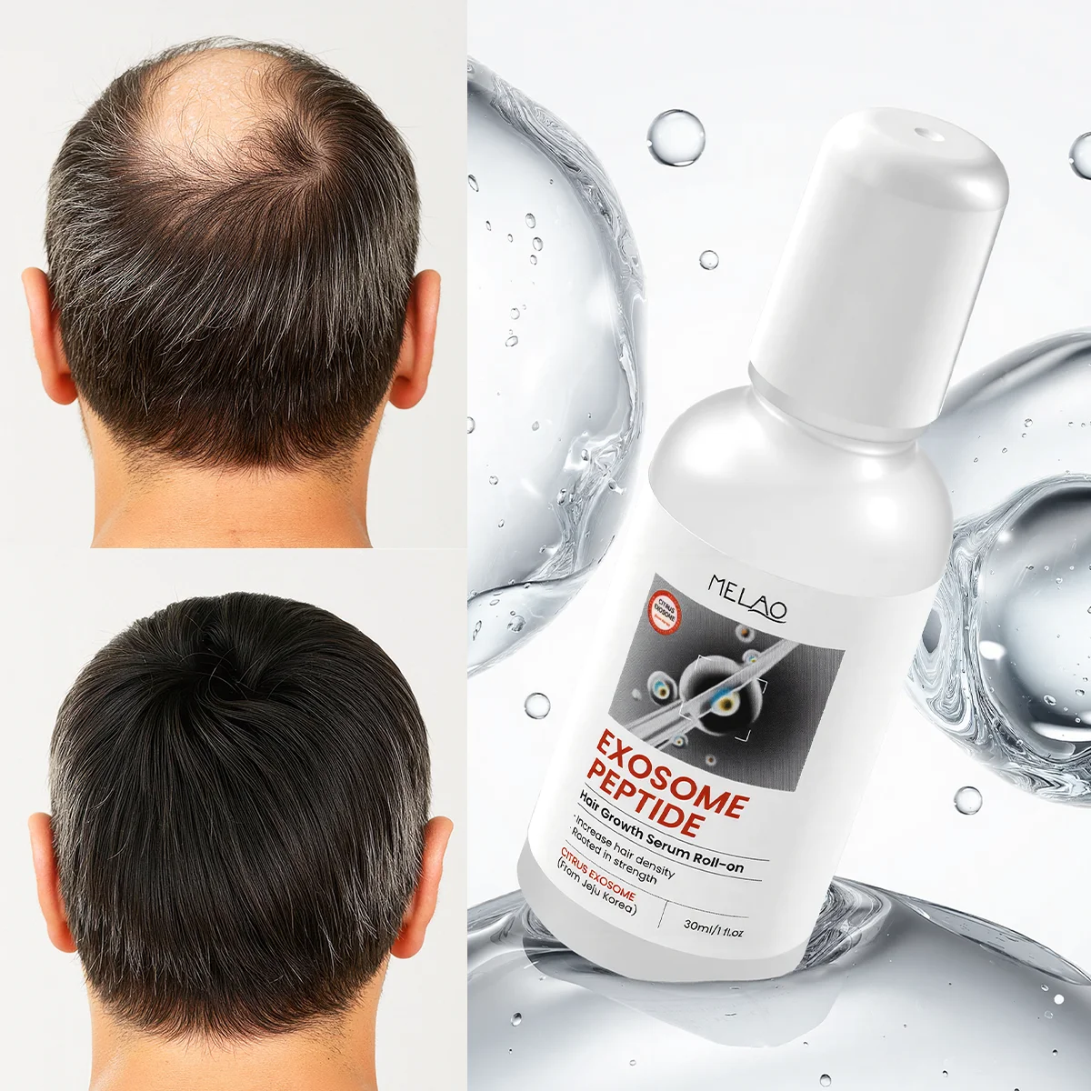 Siero Roll-on per la Crescita dei Capelli con Peptidi ed Esosomi Cura del Cuoio Capelluto Nutriente e Riparatore Etichetta Privata