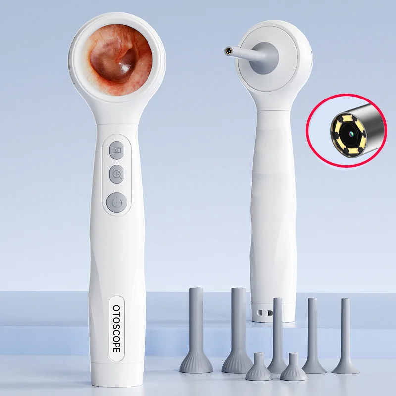 HD-Kamera-Ohrenendoskop mit 1,3-Zoll-Bildschirm zur Ohrenschmalzentfernung und Gesundheitskontrolle der Ohren, unterstützt Fotoaufnahmen Image