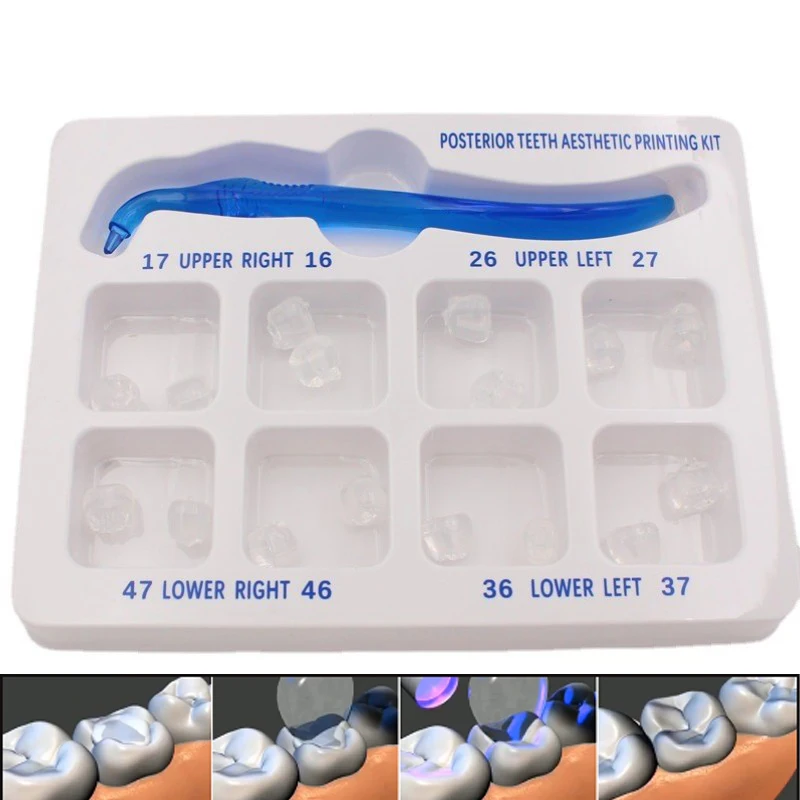 1set Dental Hintere Zähne Ästhetische Druck Mold Kit Für Licht Heilung Verbund Restaurierung Füllung Werkzeuge Zahnmedizin Image
