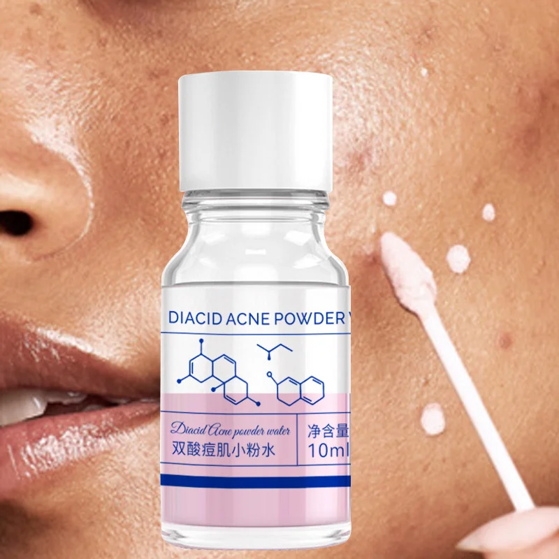 10 ml rosa Salicylsäure-Konzentrierte Akne-Essenz – mit Salicylsäure, Laktosäure, Kalamin, Doppelsäure, Doppelsäure, Doppelsäure, S Image