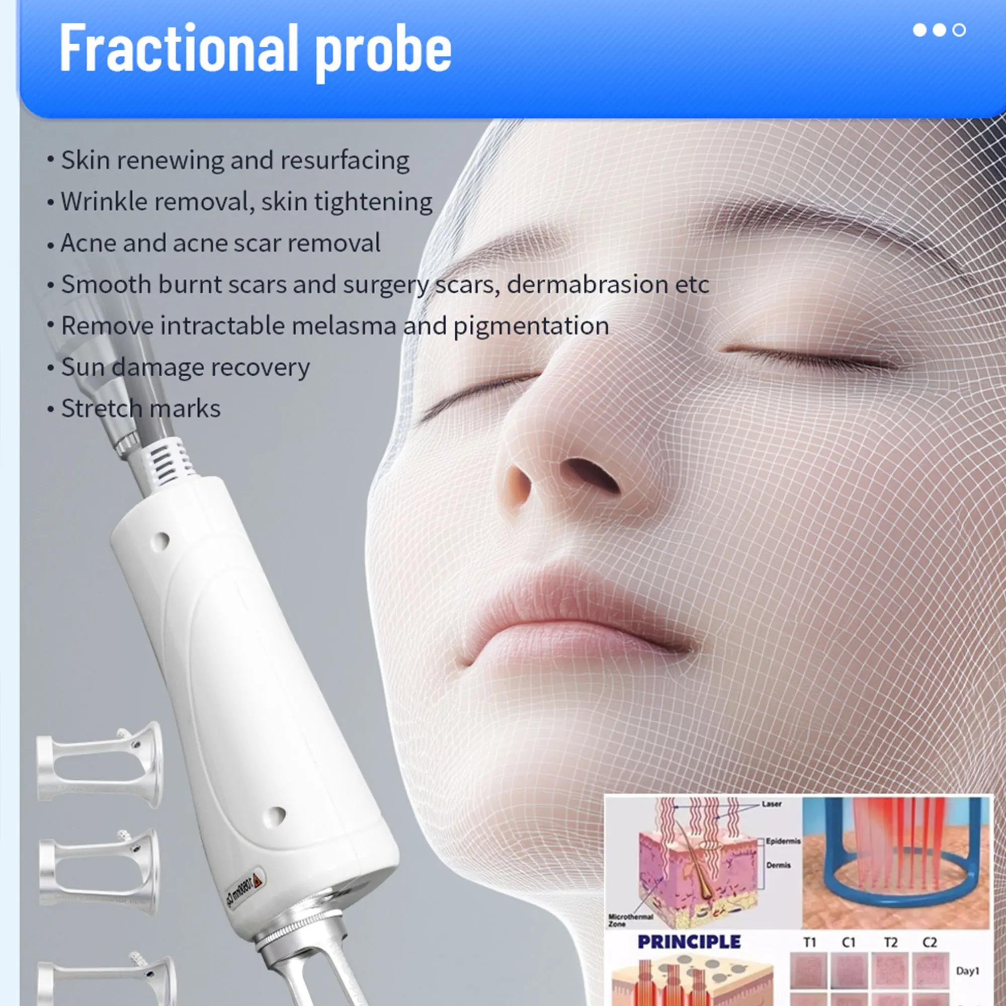 Professionelles Fraktioniertes CO2-Laser-Gerät zur Hautverjüngung, Entfernung von Aknenarben, Dehnungsstreifen und Falten, Salon-Ausrüstung Image