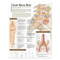 Anatomical Chart Understanding Low Back Pain